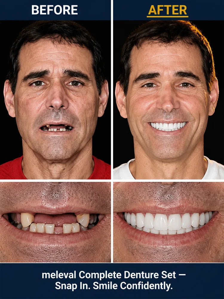 Premium Complete Denture Set