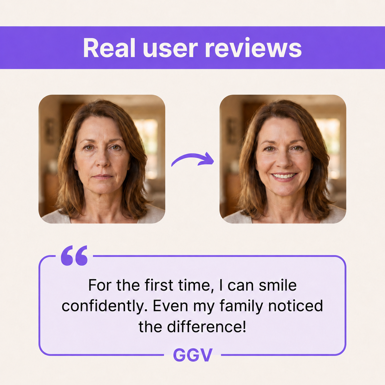 GGV Custom Denture Set
