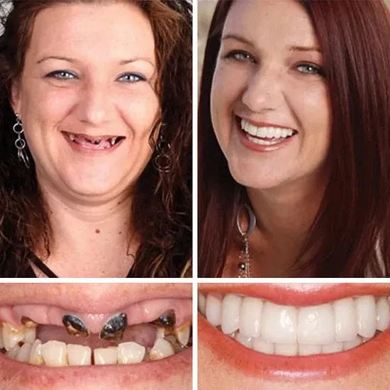 ⏰Ends Today: 70% OFF! 🌎Demany™ Medical Full Denture with Strong Suctiond🦷Obtain American Dental Association (ADA) Certification