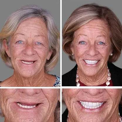 ⏰Ends Today: 70% OFF! 🌎Demany™ Medical Full Denture with Strong Suctiond🦷Obtain American Dental Association (ADA) Certification